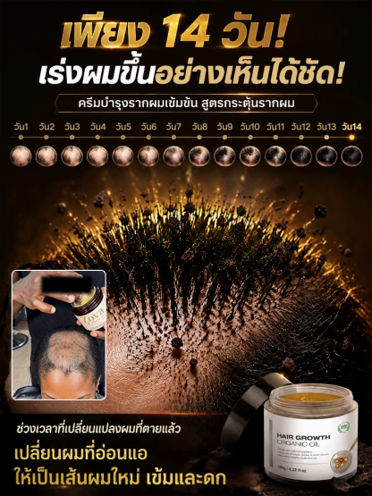 👑【ปลุกรากผมของคุณในเวลาเพียง 7 วัน!? เจลบำรุงหนังศีรษะสูตรปฏิวัติวงการที่ช่วยเพิ่มปริมาณเส้นผมได้ถึงสามเท่าอย่างน่าทึ่ง แก้ปัญหาผมบางและศีรษะล้านได้ทันที!】