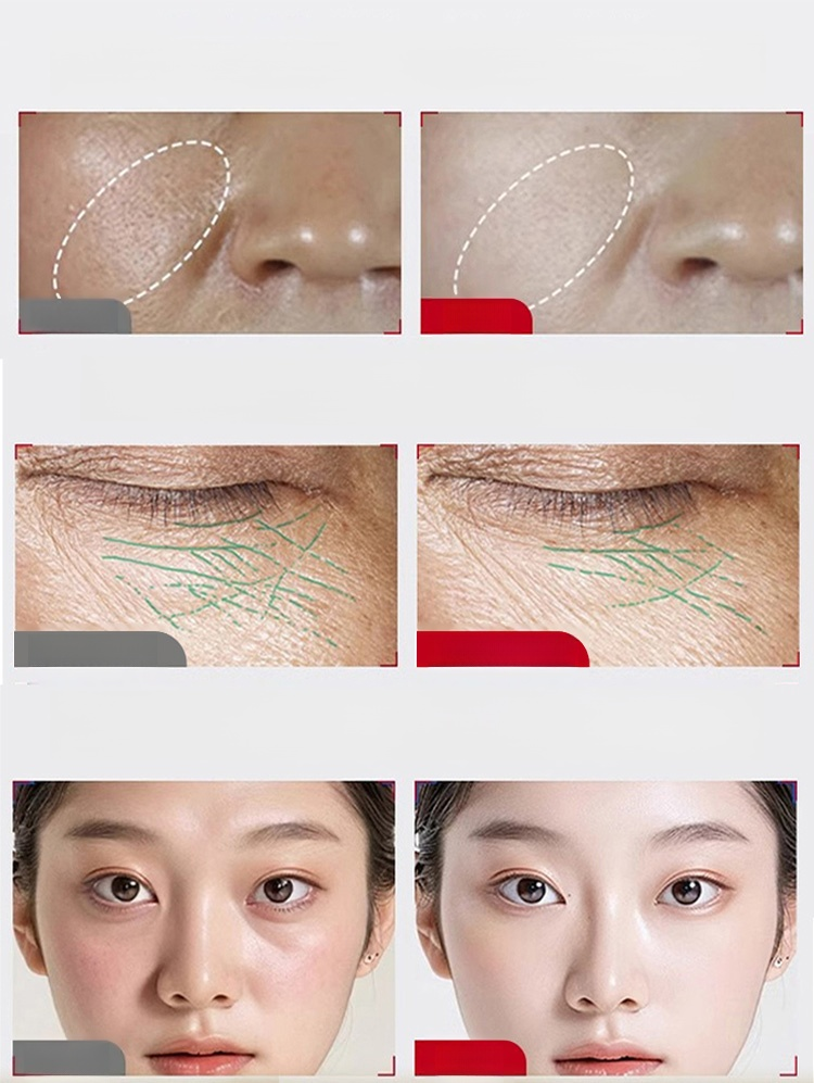 แปรงนวดหน้ากระตุ้นการไหลเวียนของน้ำเหลือง กู้หน้าบวมลดเหนียงปรับกรอบหน้าเรียวสวยเป๊ะ!