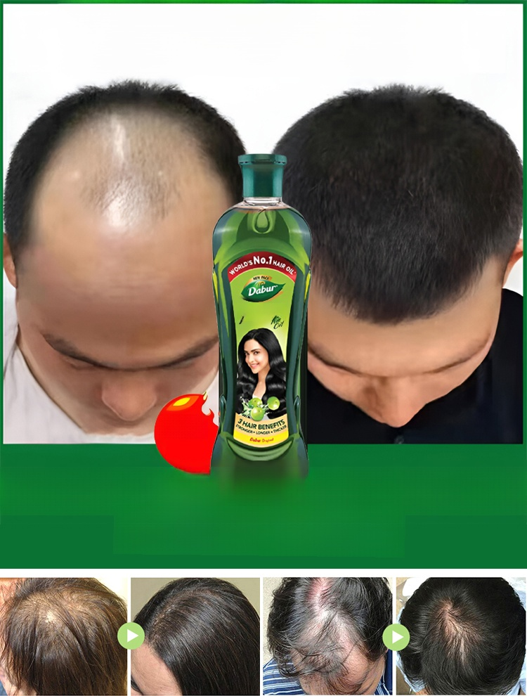 เซรั่มน้ำมันบำรุงผมเร่งผมยาวและบำรุงรากผม คืนความดกหนานุ่มสลวยและบำรุงรากผมแข็งแรงลดการหลุดร่วง