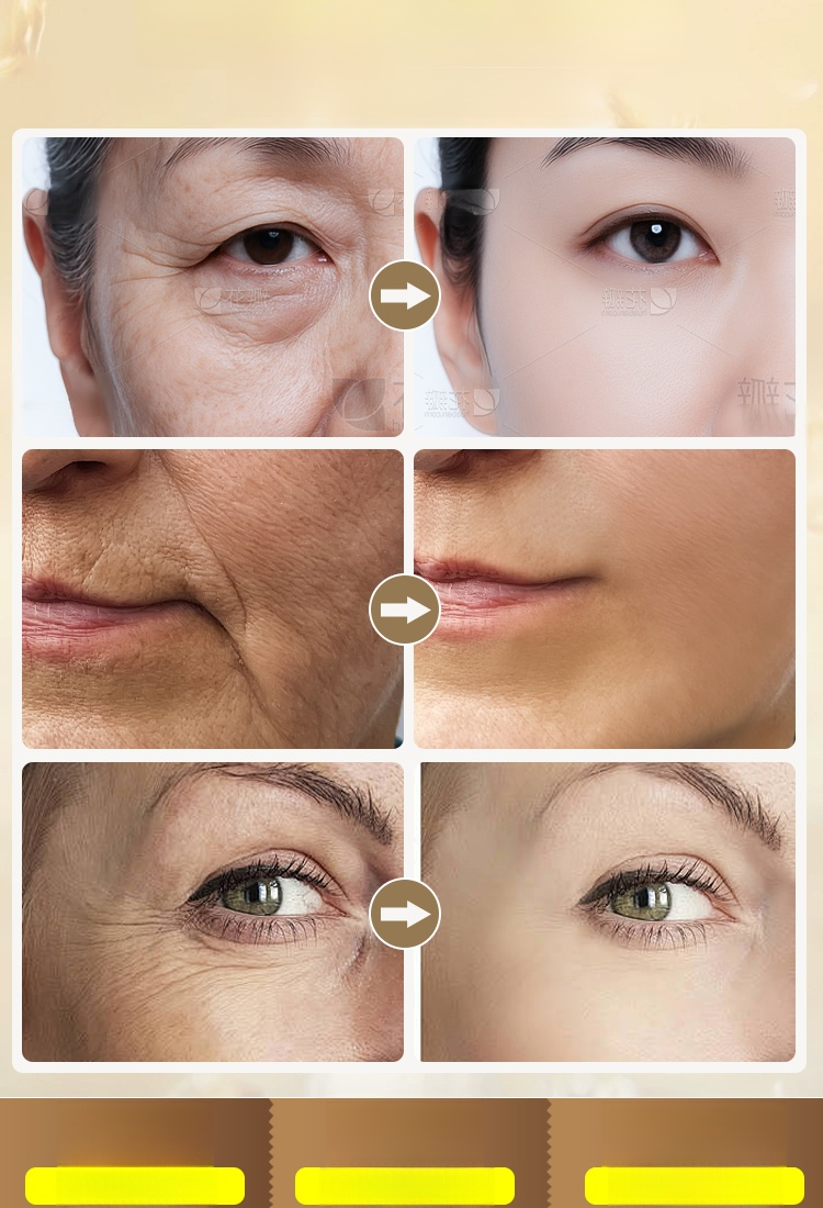 【ผลิตภัณฑ์ต่อต้านวัย】เซรั่มไวท์เทนนิ่งลดริ้วรอยบำรุงผิวด้วยน้ำมัน