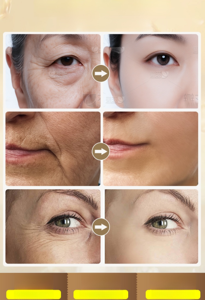 【ผลิตภัณฑ์ต่อต้านวัย】เซรั่มไวท์เทนนิ่งลดริ้วรอยบำรุงผิวด้วยน้ำมัน