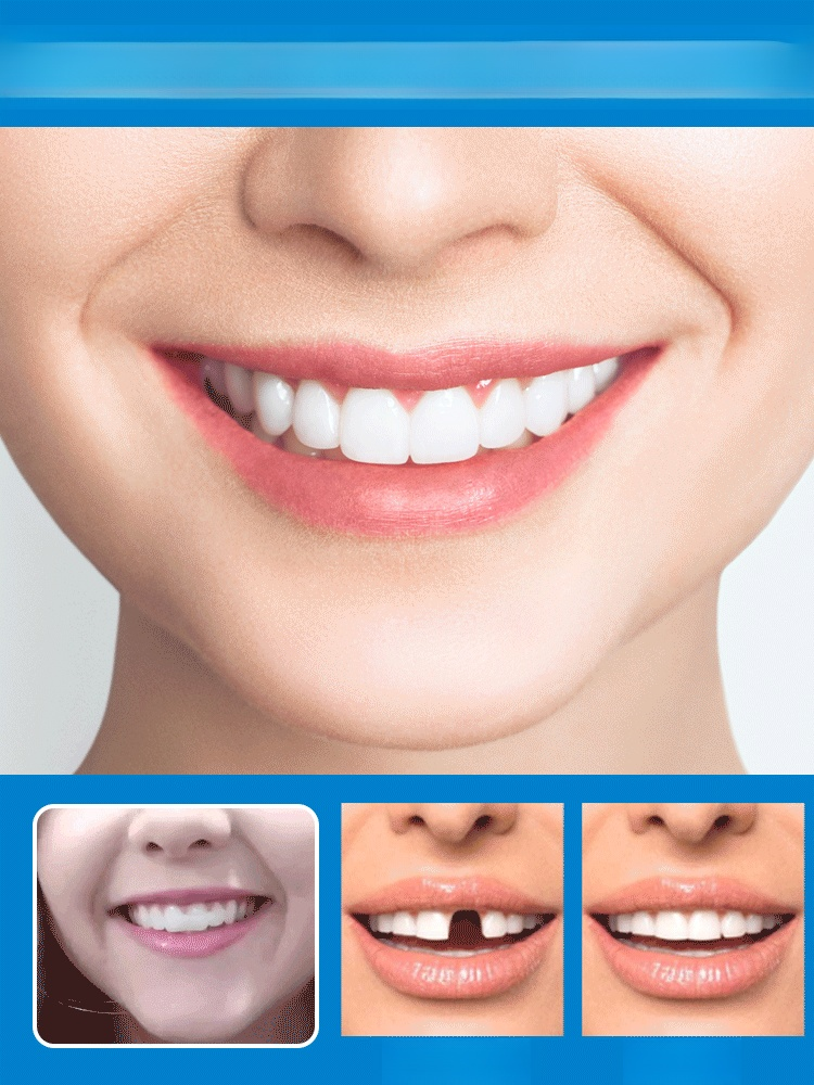 可塑型固體牙膠