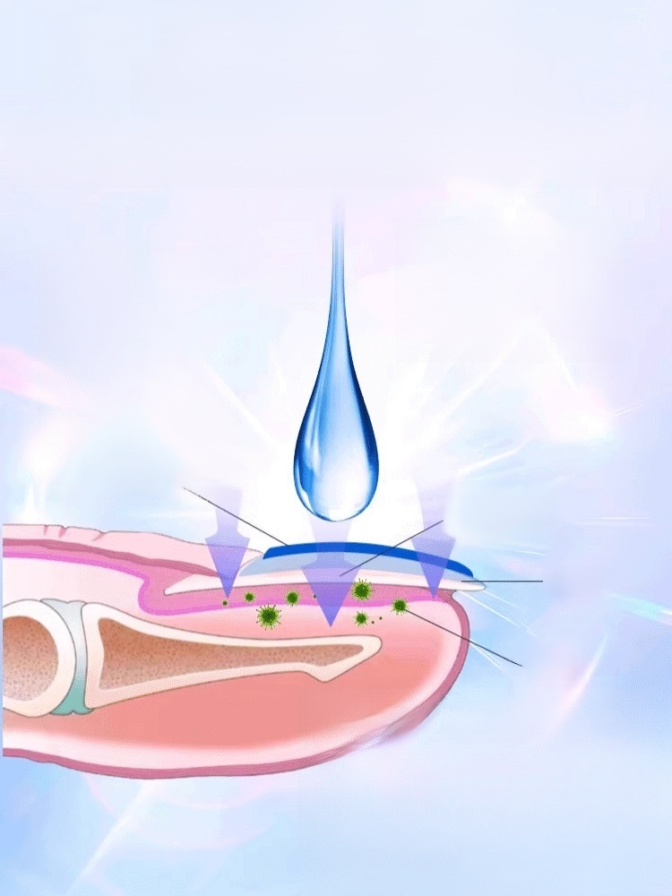 【0元購】真菌王灰指甲腳氣護理膏