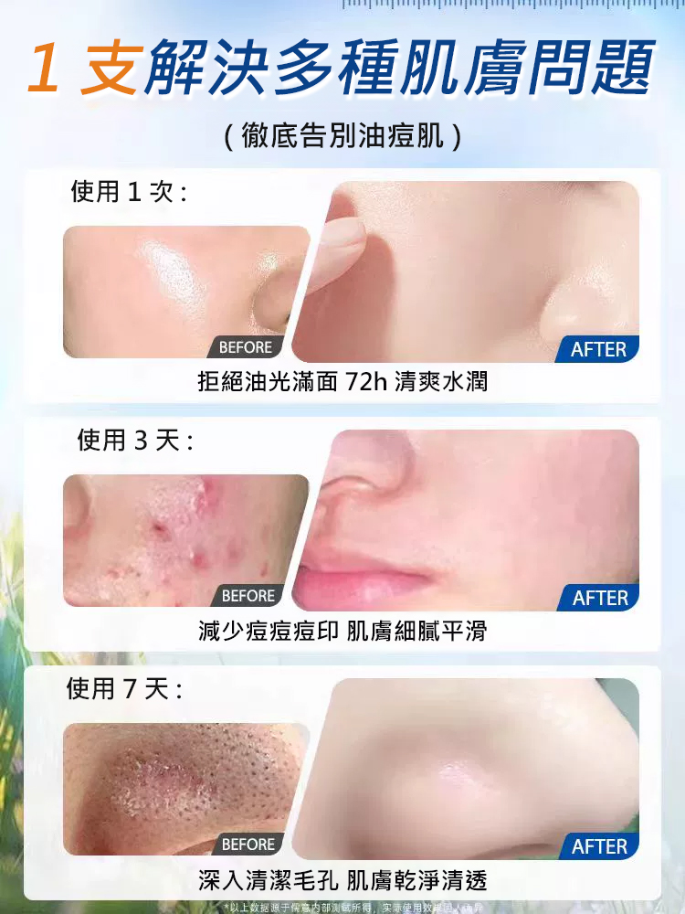 美容白醋液