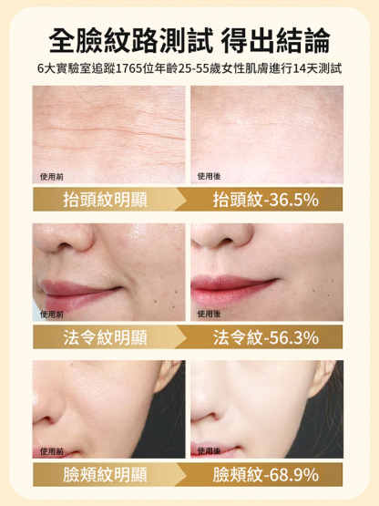 【14天抗皺】臍帶血膠原細胞精華筆