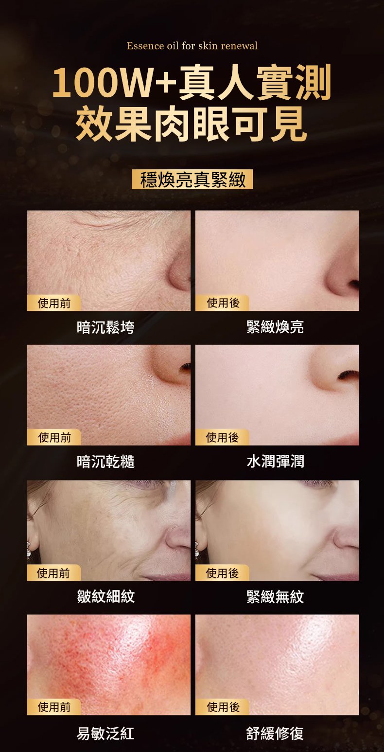 翻译件-SL-【14天抗皱】脐带血胶原细胞精华笔-1332786-系统_14.jpg