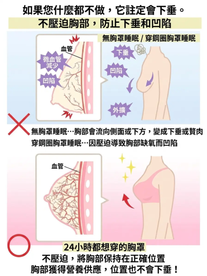 可調式無痕防垂塑型內衣