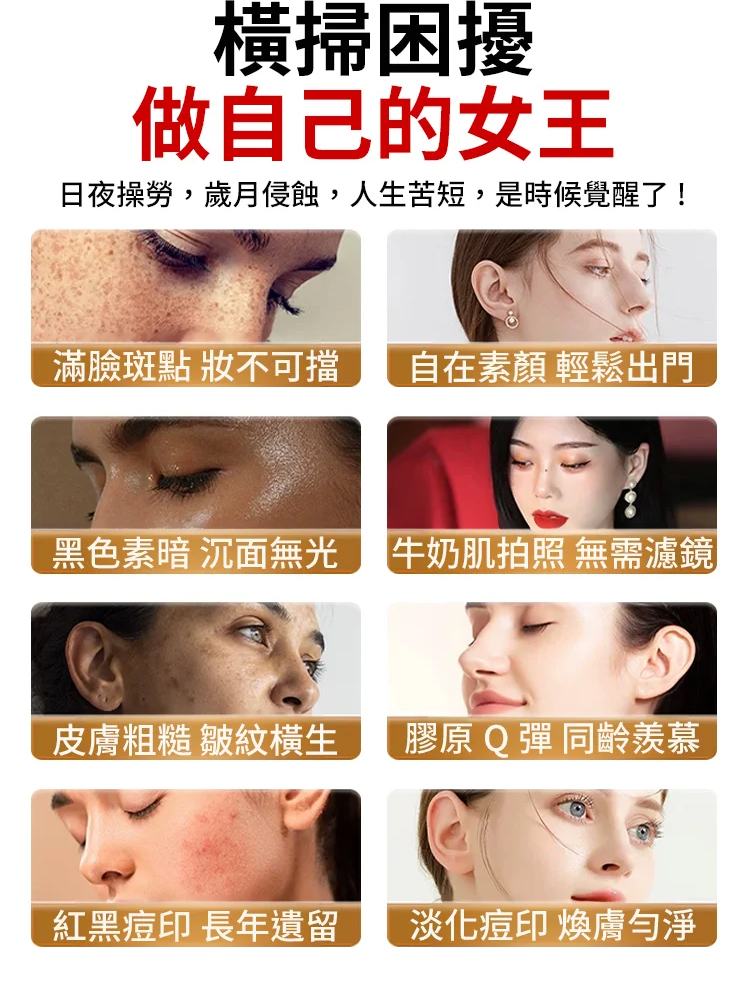 氨甲環酸美白祛斑抗皺霜