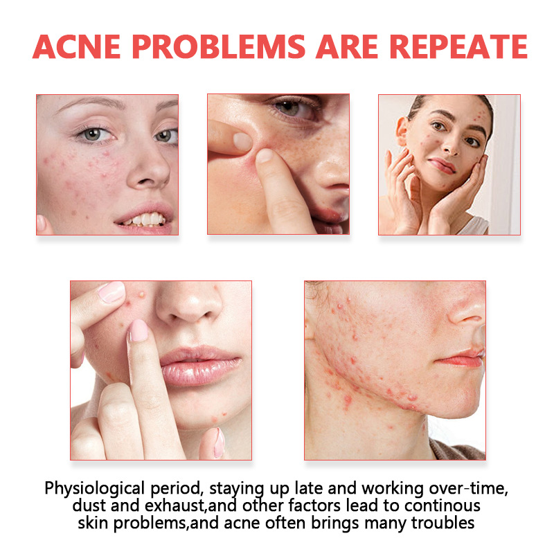 Five-Pointed Star Acne Patches Series