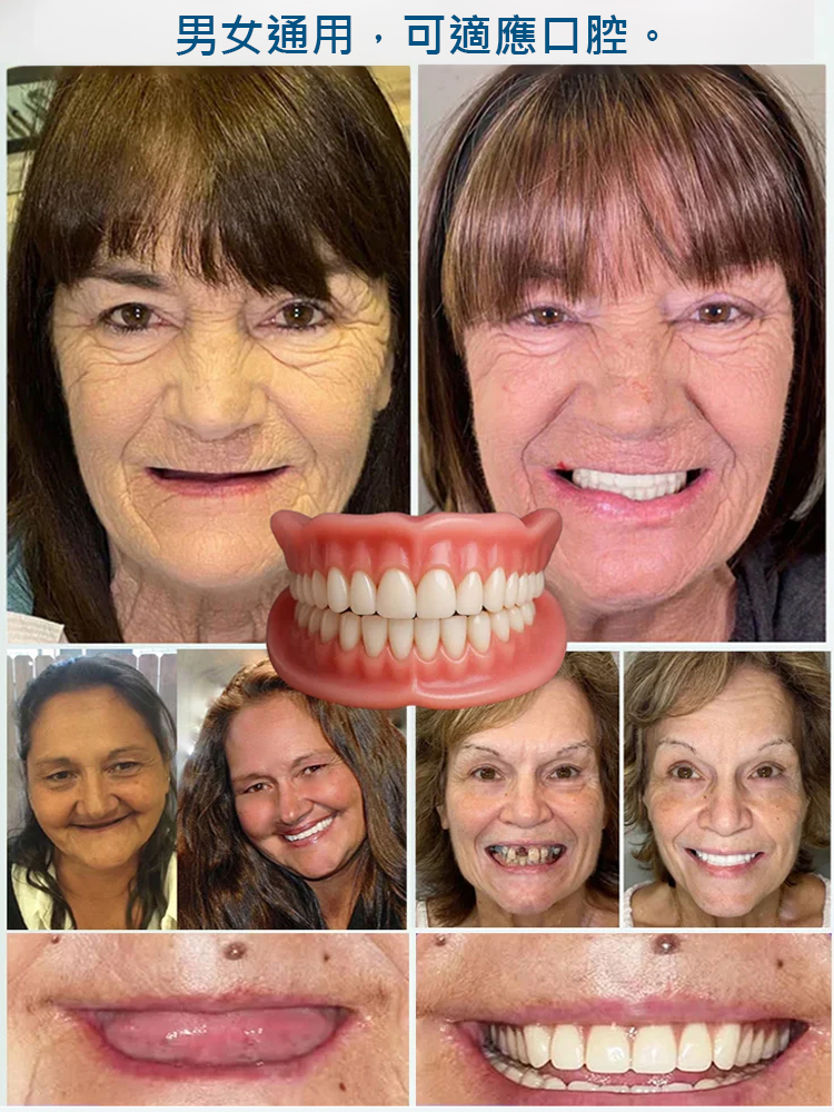 全口天然舒適牙齒美白器【FDA認證】
