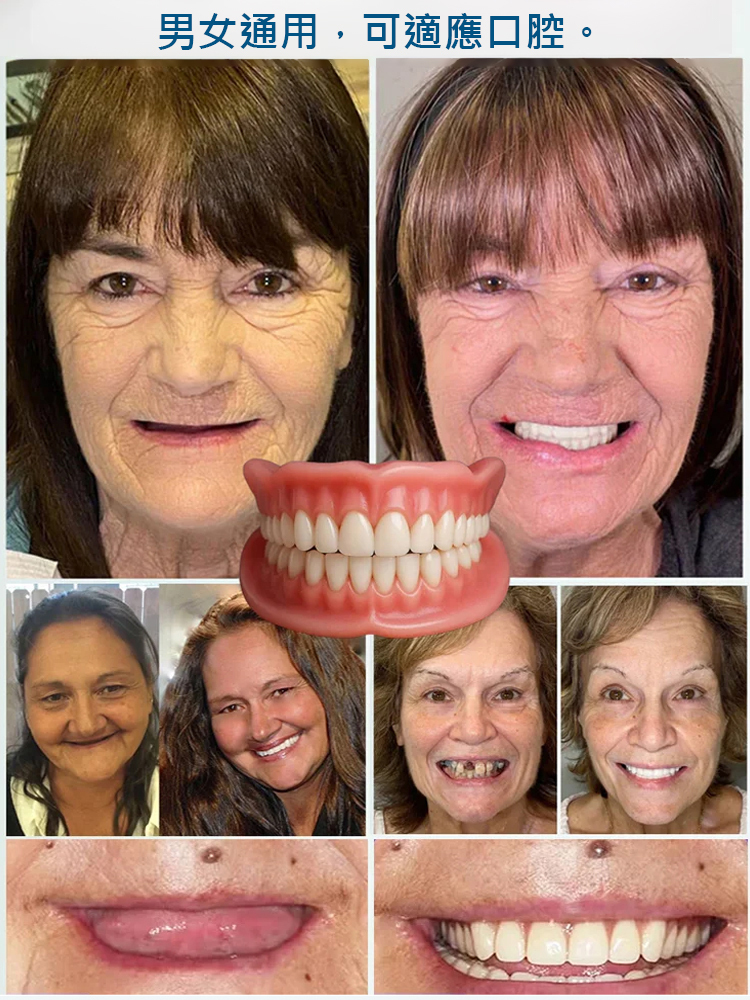 全口天然舒適牙齒美白器【FDA認證】