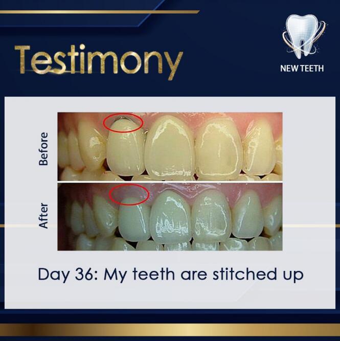 ✅Ready Stock✅[new teeth神龈粉 New Teeth | Teeth Whitening Tooth Powder Antibacteria