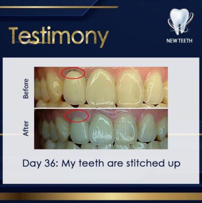 ✅Ready Stock✅[new teeth神龈粉 New Teeth | Teeth Whitening Tooth Powder Antibacteria