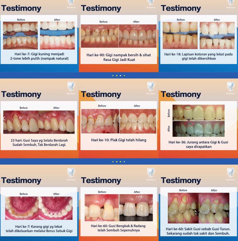 ✅Ready Stock✅[new teeth神龈粉 New Teeth | Teeth Whitening Tooth Powder Antibacteria