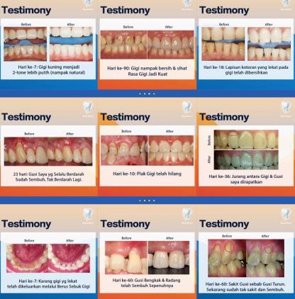 ✅Ready Stock✅[new teeth神龈粉 New Teeth | Teeth Whitening Tooth Powder Antibacteria