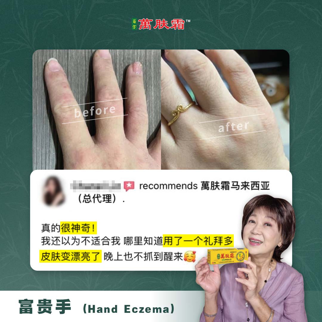 万肤霜 Ready Stock WanFuShuang Authentic