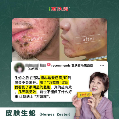 万肤霜 Ready Stock WanFuShuang Authentic