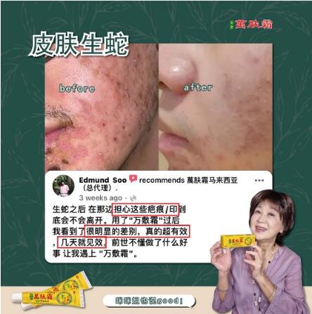 万肤霜 Ready Stock WanFuShuang Authentic