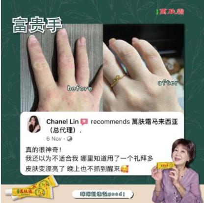 万肤霜 Ready Stock WanFuShuang Authentic