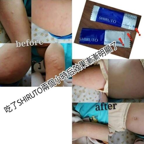 BELIXZ SHIRUTO 免疫系统维生素SHI-RU-TO Vitamin Immune system 免疫系統救星 (1g*30sach）