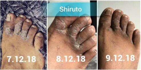 BELIXZ SHIRUTO 免疫系统维生素SHI-RU-TO Vitamin Immune system 免疫系統救星 (1g*30sach）