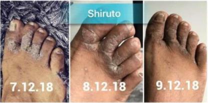 BELIXZ SHIRUTO 免疫系统维生素SHI-RU-TO Vitamin Immune system 免疫系統救星 (1g*30sach）