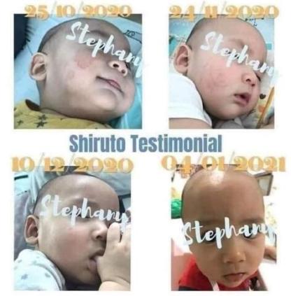 BELIXZ SHIRUTO 免疫系统维生素SHI-RU-TO Vitamin Immune system 免疫系統救星 (1g*30sach）