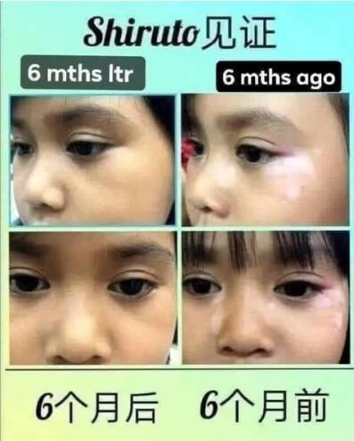 BELIXZ SHIRUTO 免疫系统维生素SHI-RU-TO Vitamin Immune system 免疫系統救星 (1g*30sach）