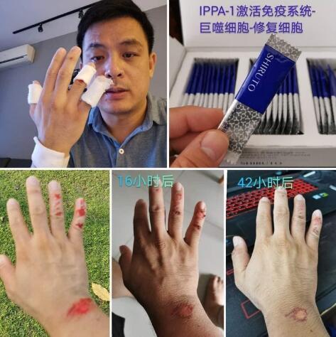 BELIXZ SHIRUTO 免疫系统维生素SHI-RU-TO Vitamin Immune system 免疫系統救星 (1g*30sach）