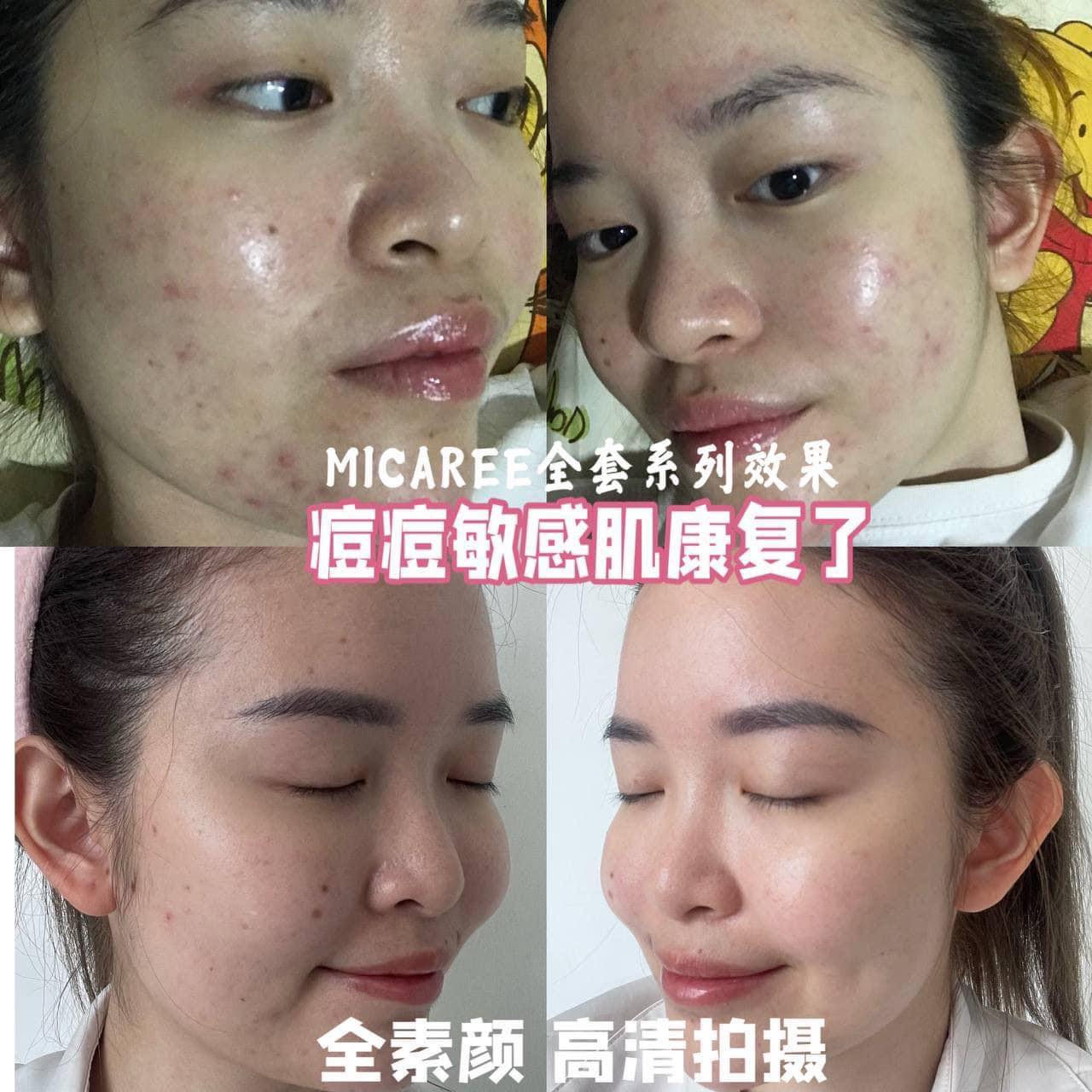 MICAREE OT Cream Whitening & Moisturizing Skin Treatment – BB Cream, Primer & Sunscreen all in One