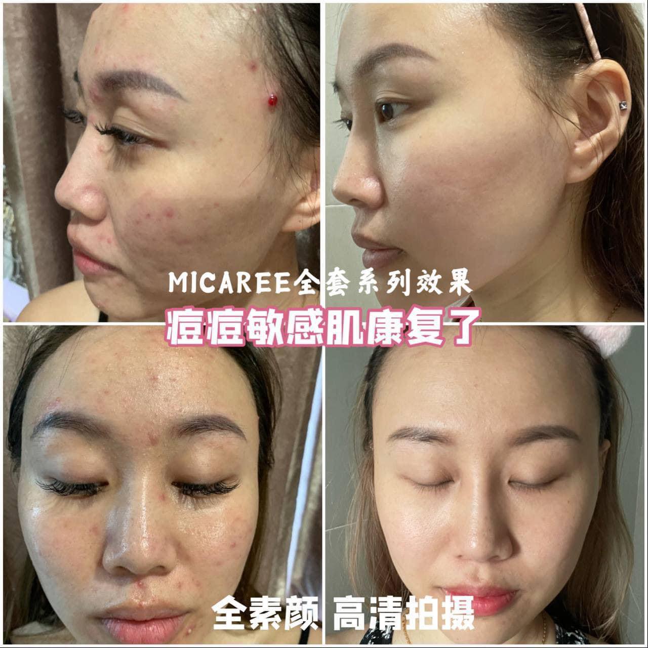 MICAREE OT Cream Whitening & Moisturizing Skin Treatment – BB Cream, Primer & Sunscreen all in One