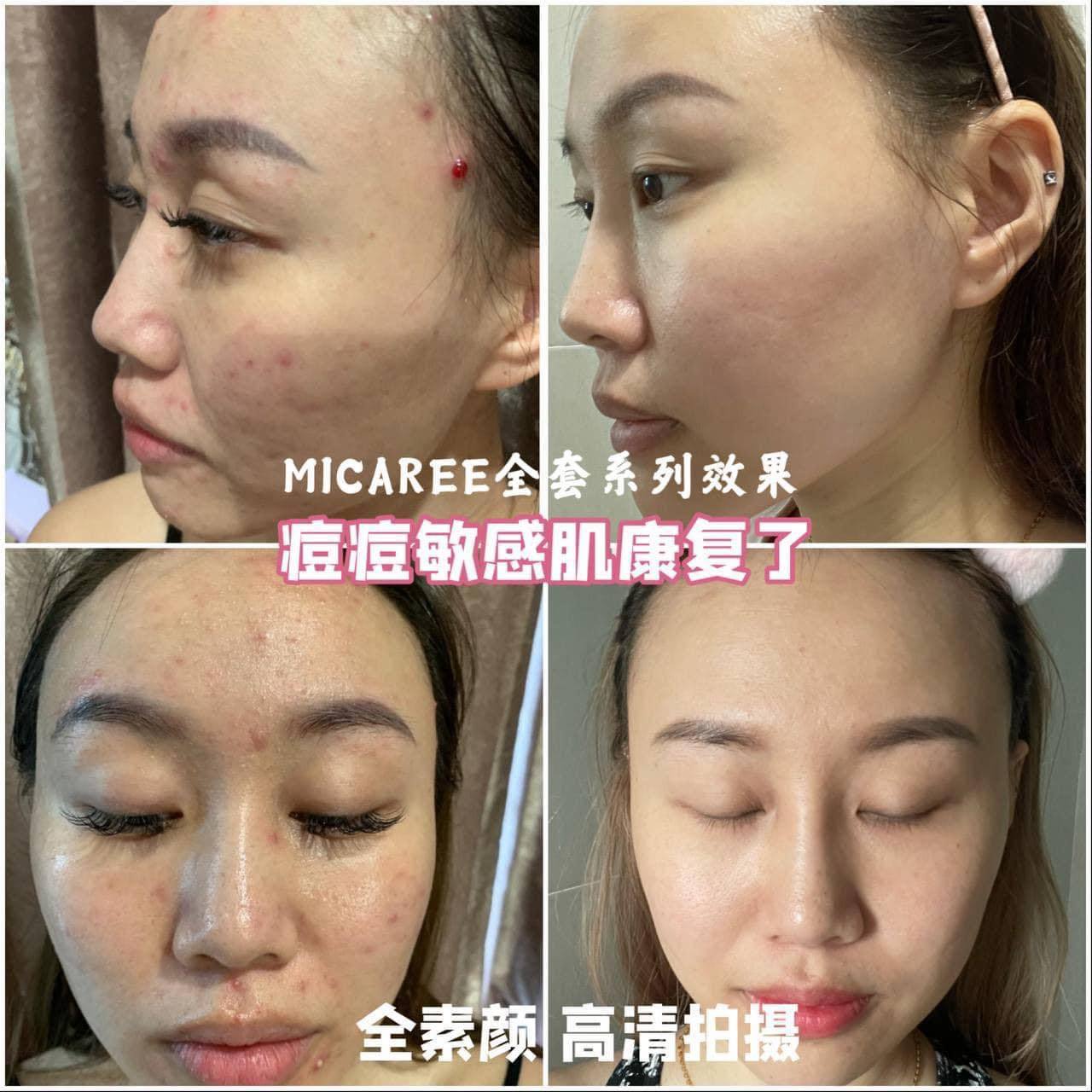 MICAREE OT Cream Whitening & Moisturizing Skin Treatment – BB Cream, Primer & Sunscreen all in One