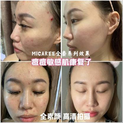 MICAREE OT Cream Whitening & Moisturizing Skin Treatment – BB Cream, Primer & Sunscreen all in One