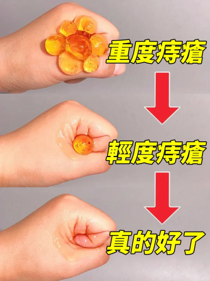【一抹見效】槐花馬齒莧斷痔膏