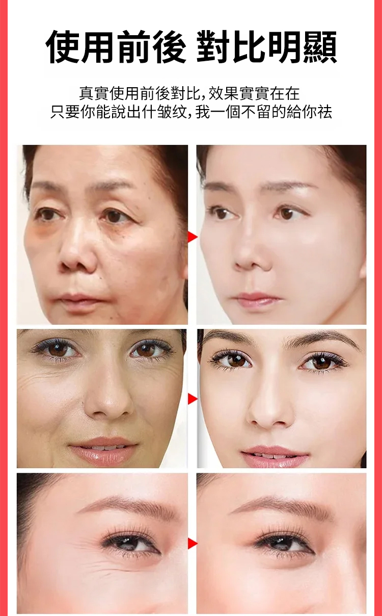 翻译件-SL-重组胶原蛋白抗皱精华液-1177382-系统_12.jpg