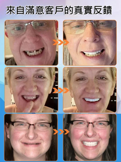 【英國新研究成果】矽膠仿真牙齒牙套