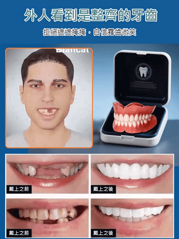 【英國新研究成果】矽膠仿真牙齒牙套