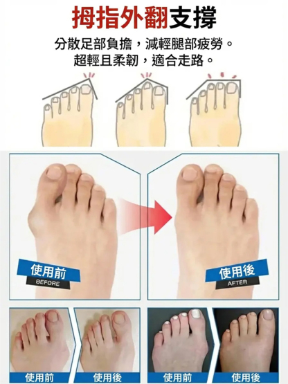 舒適自動紐帶皮鞋