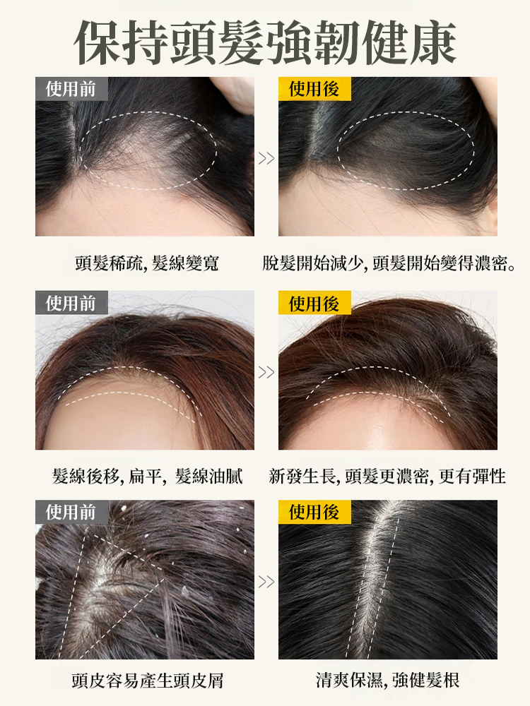 電動噴霧氣囊按摩梳