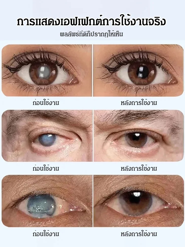 【ห่างไกลจากโรคตา】ยาหยอดตามีลูทีนจากบลูเบอร์รี่