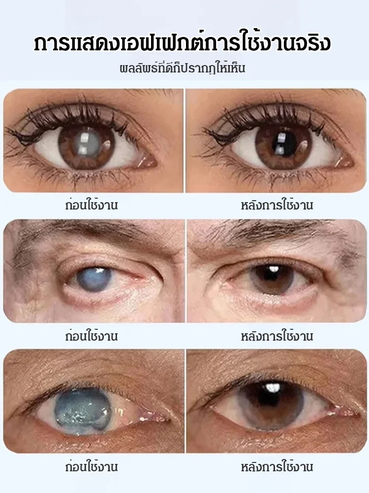 【ห่างไกลจากโรคตา】ยาหยอดตามีลูทีนจากบลูเบอร์รี่