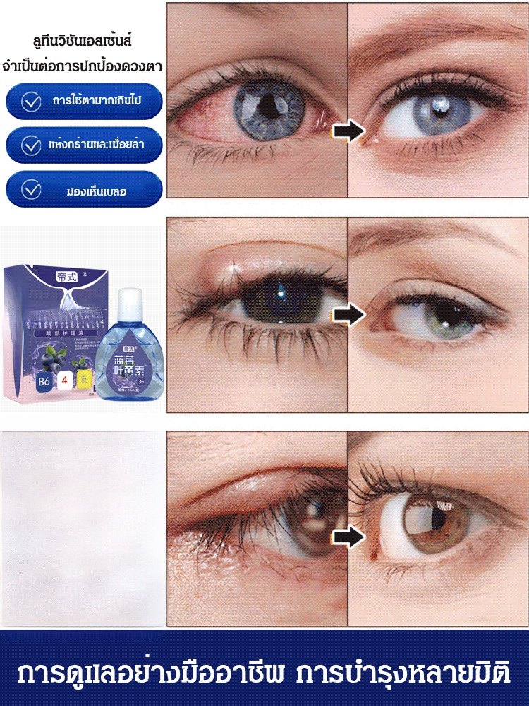 【ห่างไกลจากโรคตา】ยาหยอดตามีลูทีนจากบลูเบอร์รี่