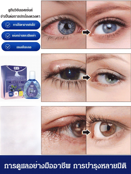 【ห่างไกลจากโรคตา】ยาหยอดตามีลูทีนจากบลูเบอร์รี่