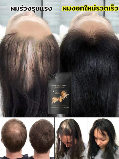 แชมพูสมุนไพรเห็ดหลินจือดำและโชวู