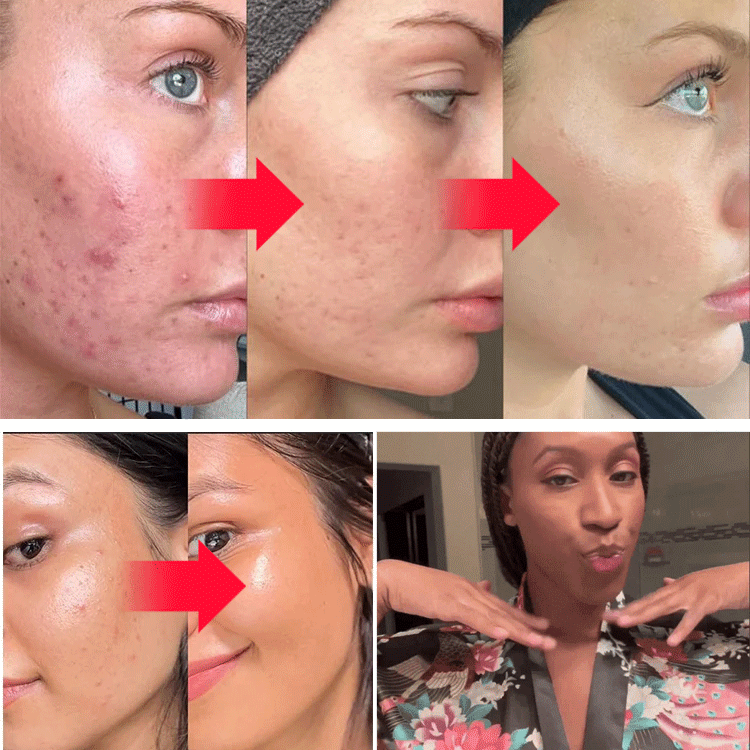 Turmeric Kojic Acid Detoxifying and Brightening Cleansing Facial Soap