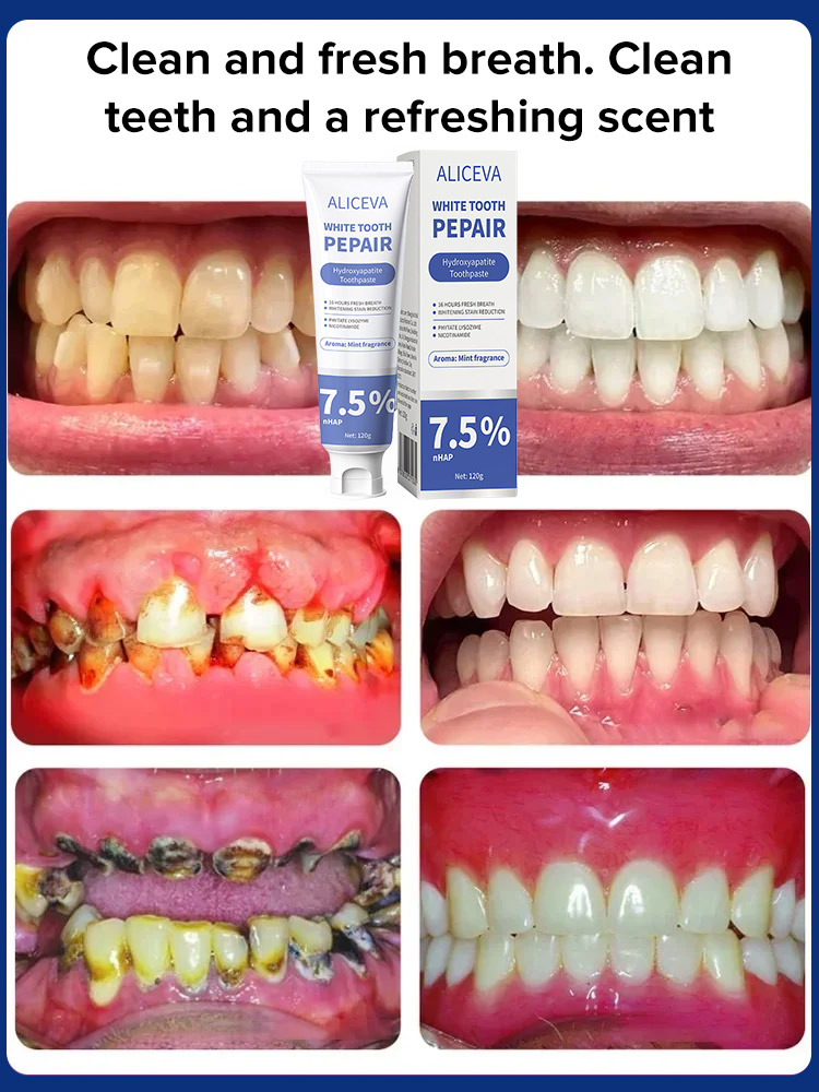 Hydroxyapatite repair toothpaste