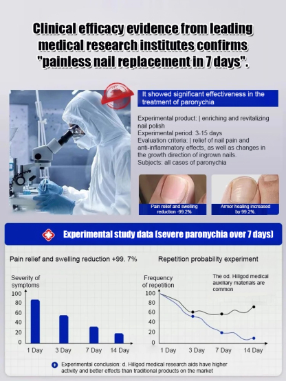 Antifungal nail solution