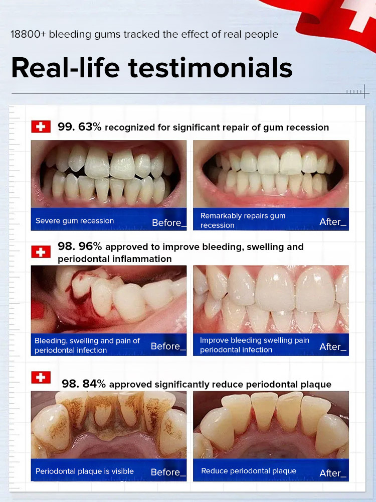 Hydroxyapatite repair toothpaste