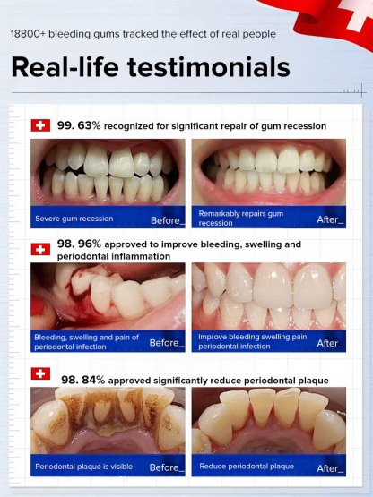 Hydroxyapatite repair toothpaste