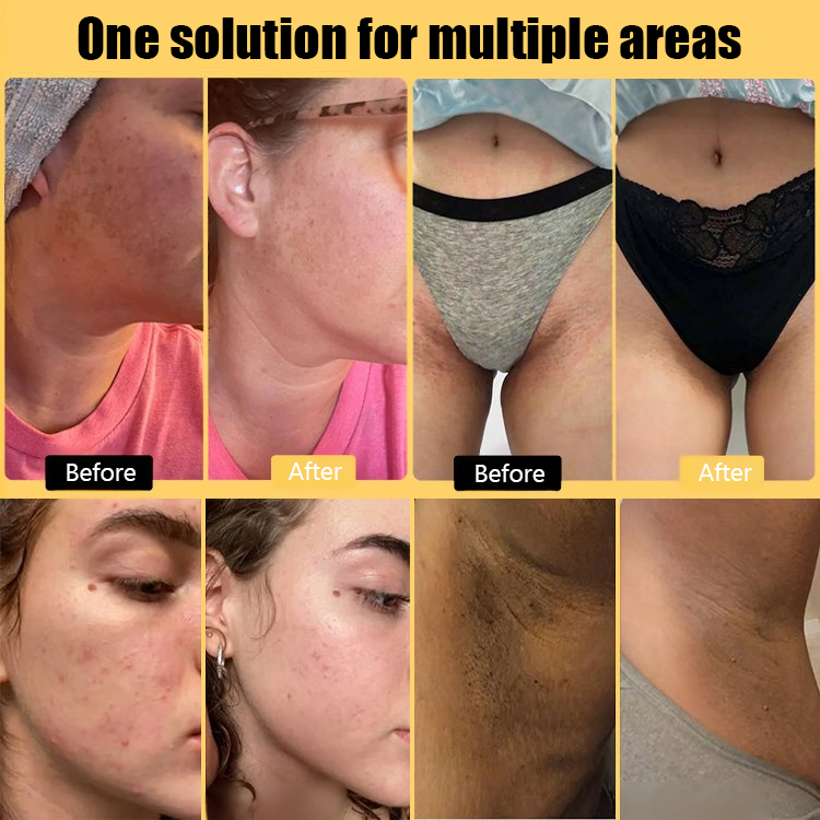 Turmeric Kojic Acid Detoxifying and Brightening Cleansing Facial Soap